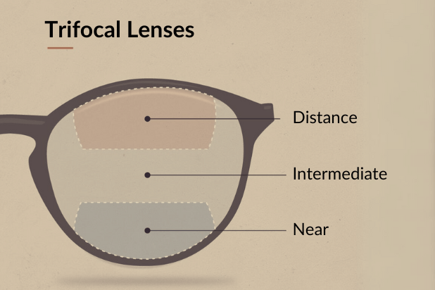 Tutela Eye Care | Glaucoma Diagnosis   Management, Refractive Cataract Surgery and Diabetic Eye Exams